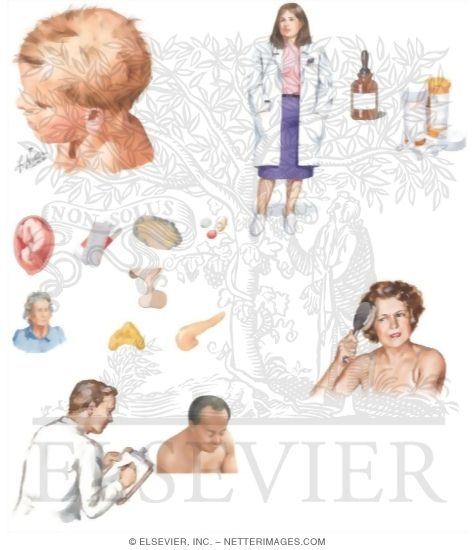 Watermarked preview of unlabeled image: Managing Your Alopecia