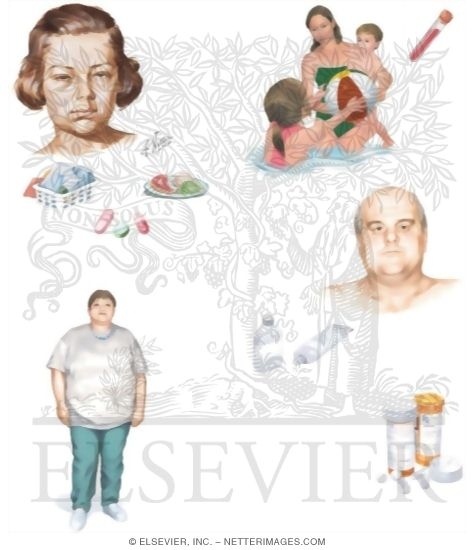 Watermarked preview of unlabeled image: Managing Your Angioedema