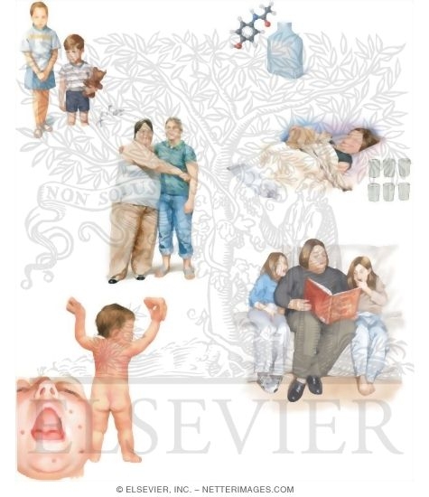 Watermarked preview of labeled image: Managing Your Chickenpox