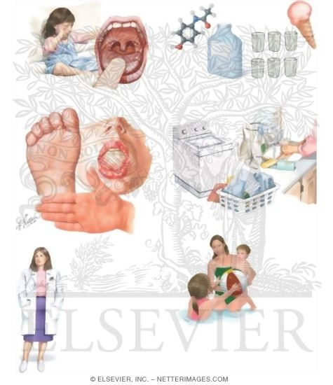 Watermarked preview of unlabeled image: Caring for Your Child With Hand, Foot, and Mouth Disease
