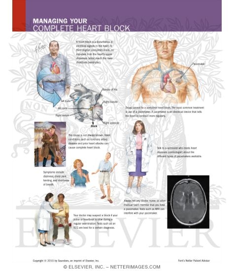 Managing Your Complete Heart Block