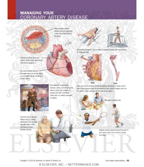 Watermarked preview of labeled image: Managing Your Coronary Artery Disease