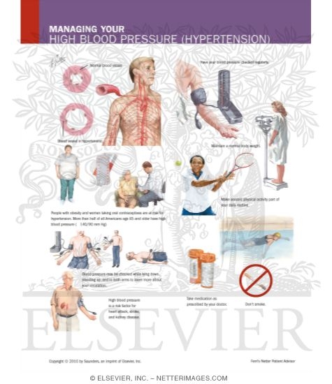 Watermarked preview of labeled image: Managing Your High Blood Pressure (Hypertension)