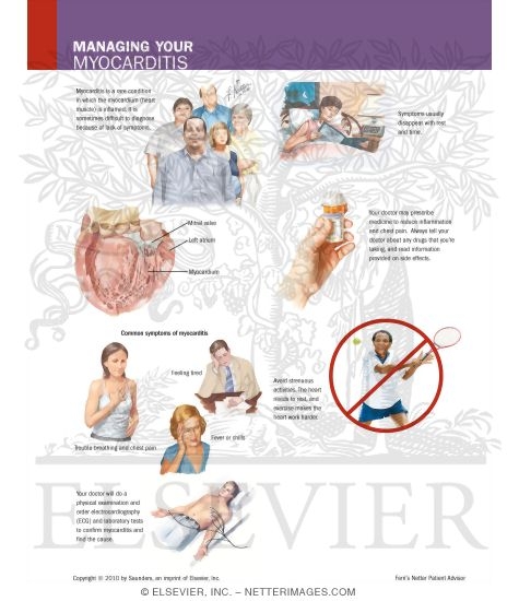 Watermarked preview of labeled image: Managing Your Myocarditis