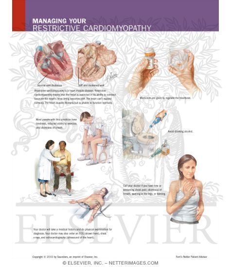 Watermarked preview of labeled image: Managing Your Restrictive Cardiomyopathy
