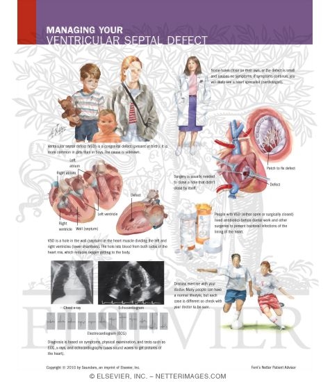Watermarked preview of labeled image: Managing Your Ventricular Septal Defect