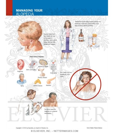 Watermarked preview of labeled image: Managing Your Alopecia