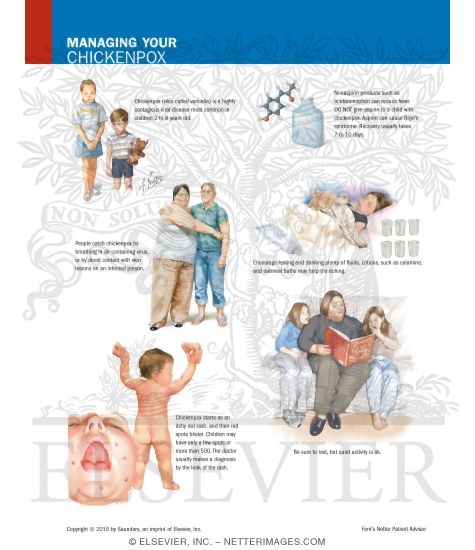 Watermarked preview of labeled image: Managing Your Chickenpox