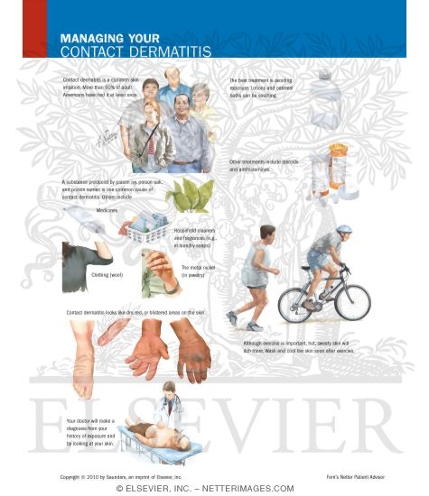 Watermarked preview of labeled image: Managing Your Contact Dermatitis