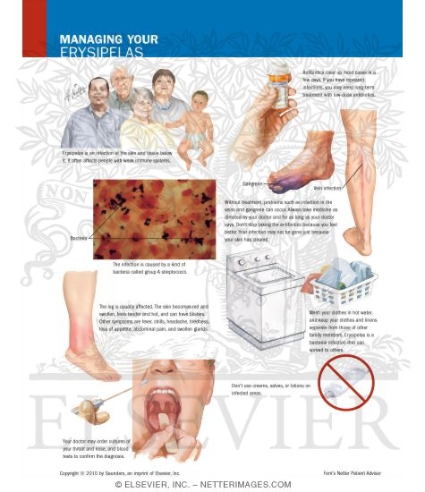 Watermarked preview of labeled image: Managing Your Erysipelas