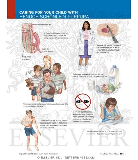 Caring for Your Child With Henoch-Schönlein Purpura