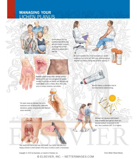 Watermarked preview of labeled image: Managing Your Lichen Planus