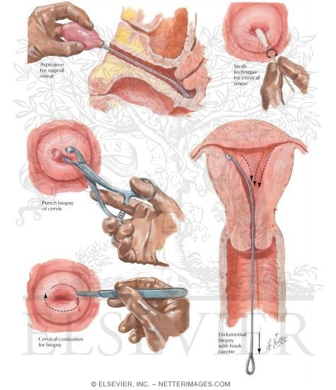 Watermarked preview of labeled image: Diagnostic Procedures I - Vaginal Smear, Cervical and Endometrial Biopsies