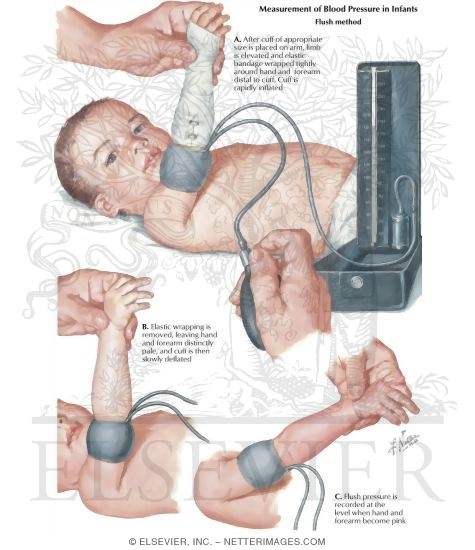 Baby top blood pressure