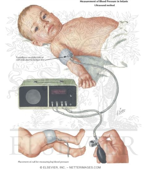 Measurement Of Blood Pressure In Infants Ultrasound Method