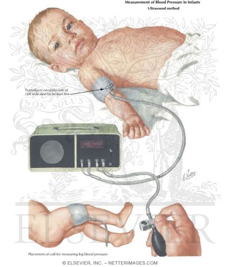 Measuring Blood Pressure in Children