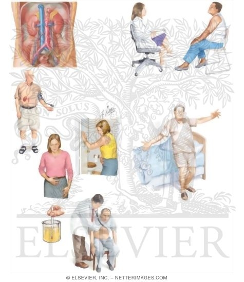 Watermarked preview of unlabeled image: Managing Your Aldosteronism