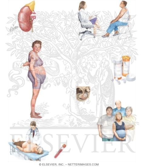 Managing Your Cushing's Syndrome