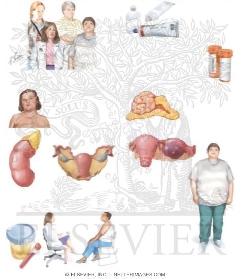 Watermarked preview of unlabeled image: Managing Your Hirsutism