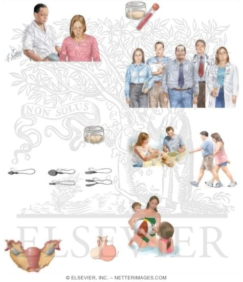 Watermarked preview of unlabeled image: Understanding Infertility