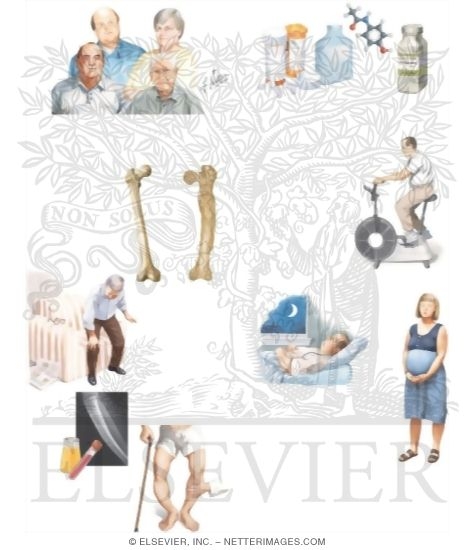 Watermarked preview of unlabeled image: Understanding Your Paget's Disease of Bone