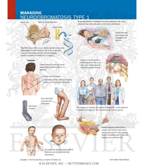 Watermarked preview of labeled image: Managing Neurofibromatosis Type 1