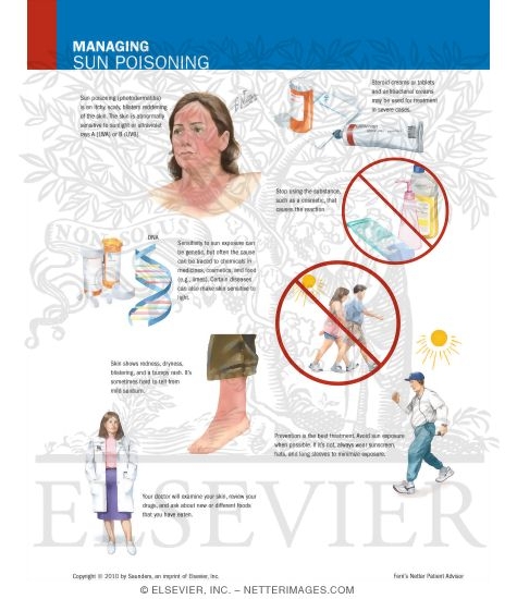 Watermarked preview of labeled image: Managing Sun Poisoning