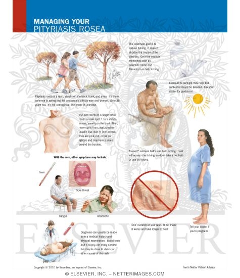Managing Your Pityriasis Rosea