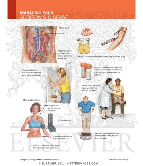 Watermarked preview of labeled image: Managing Your Addison's Disease