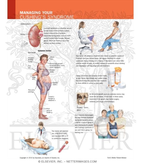 Managing Your Cushing's Syndrome