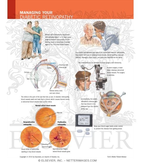 Watermarked preview of labeled image: Managing Your Diabetic Retinopathy