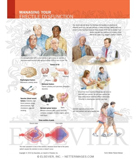 Watermarked preview of labeled image: Managing Your Erectile Dysfunction