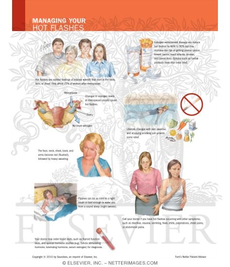 Watermarked preview of labeled image: Managing Your Hot Flashes