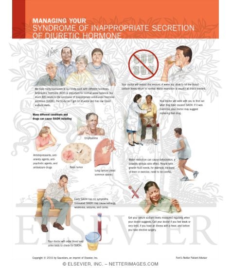 Watermarked preview of labeled image: Managing Your Syndrome of Inappropriate Secretion of Diuretic Hormone
