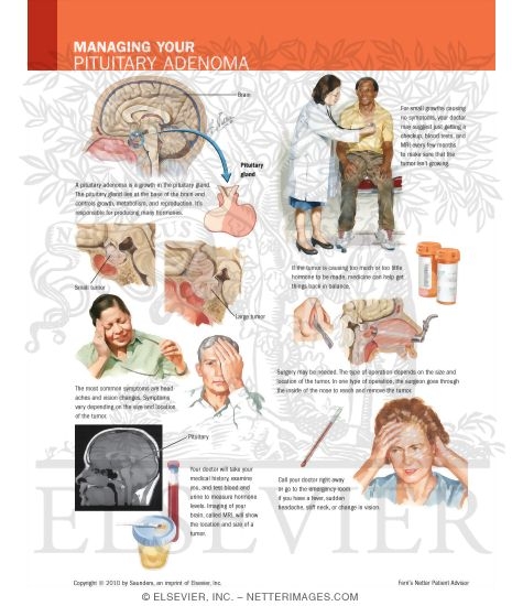 Watermarked preview of labeled image: Managing Your Pituitary Adenoma