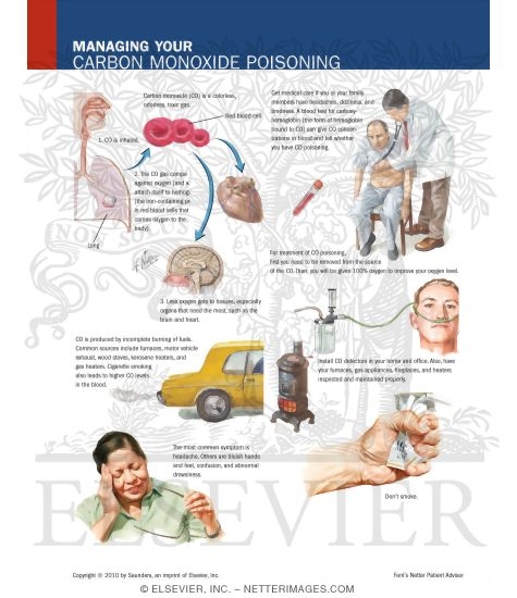 Watermarked preview of labeled image: Managing Your Carbon Monoxide Poisoning