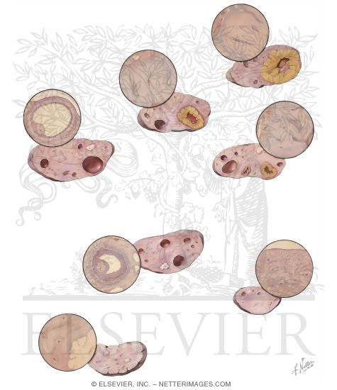The Ovary