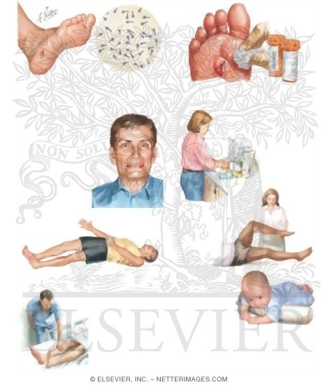 Managing Your Tetanus