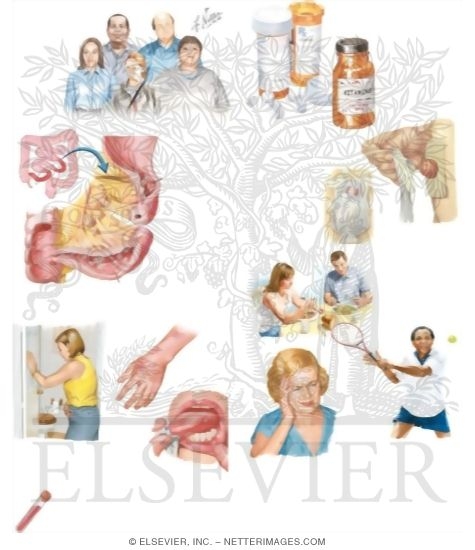 Watermarked preview of unlabeled image: Managing Your Crohn's Disease