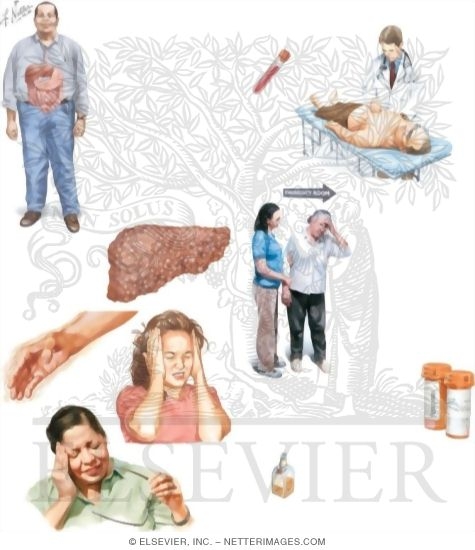 Watermarked preview of unlabeled image: Managing Your Hepatic Encephalopathy
