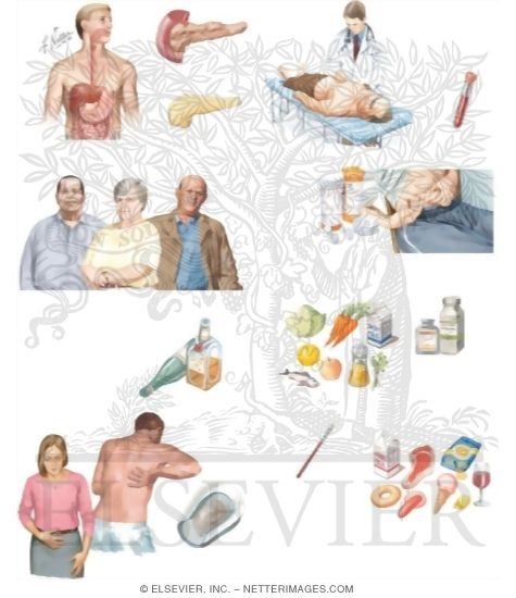 Watermarked preview of unlabeled image: Managing Your Chronic Pancreatitis