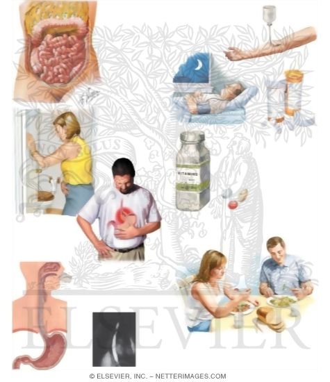 Watermarked preview of unlabeled image: Managing Your Short Bowel Syndrome