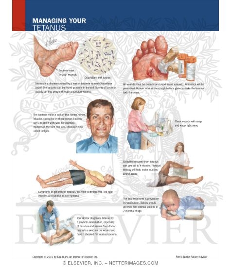 Watermarked preview of labeled image: Managing Your Tetanus