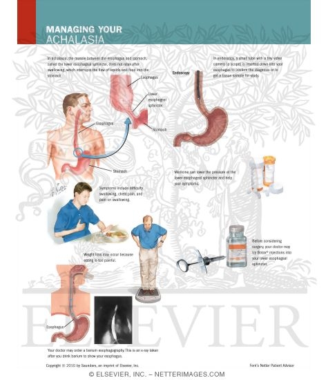 Managing Your Achalasia