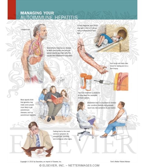 Watermarked preview of labeled image: Managing Your Autoimmune Hepatitis