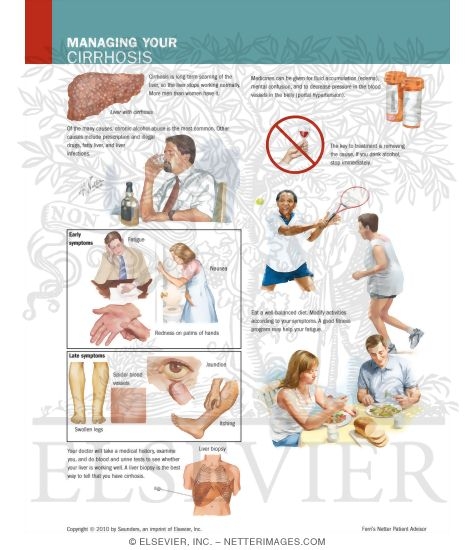 Watermarked preview of labeled image: Managing Your Cirrhosis