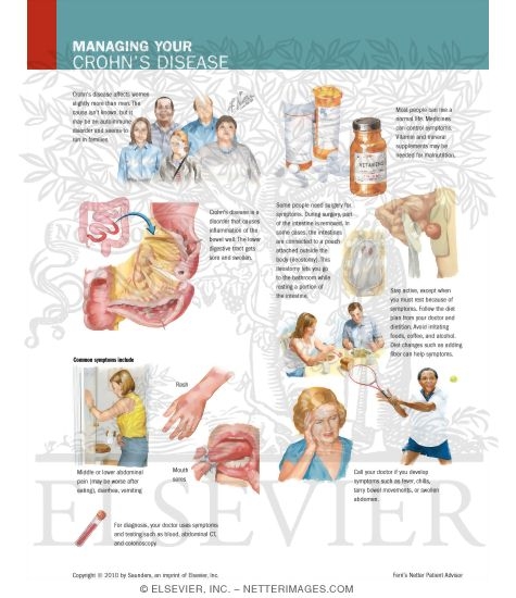 Watermarked preview of labeled image: Managing Your Crohn's Disease