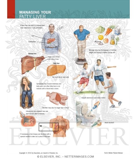 Watermarked preview of labeled image: Managing Your Fatty Liver