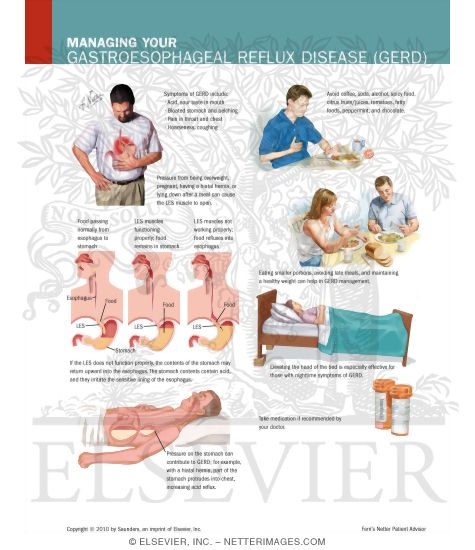 Watermarked preview of labeled image: Managing Your Gastroesophageal Reflux Disease (GERD)