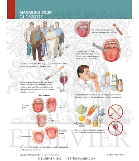 Managing Your Glossitis
